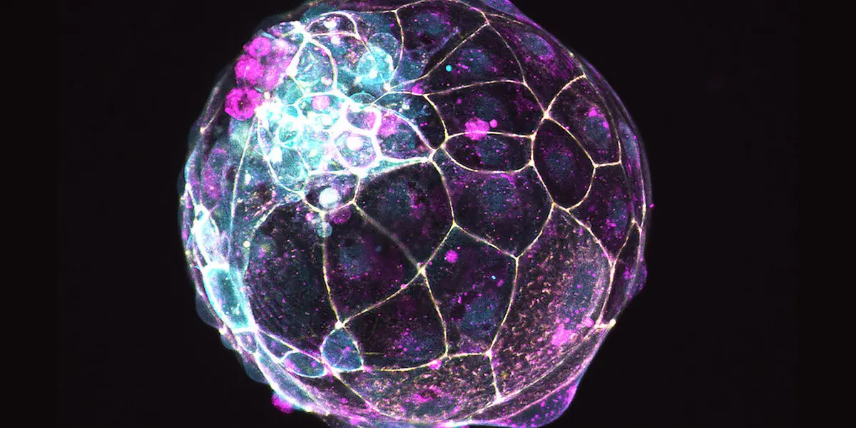 Científicos utilizan células madres para crear la imitación de un preembrión: Ayudará a la investigación de Fecundación in vitro
